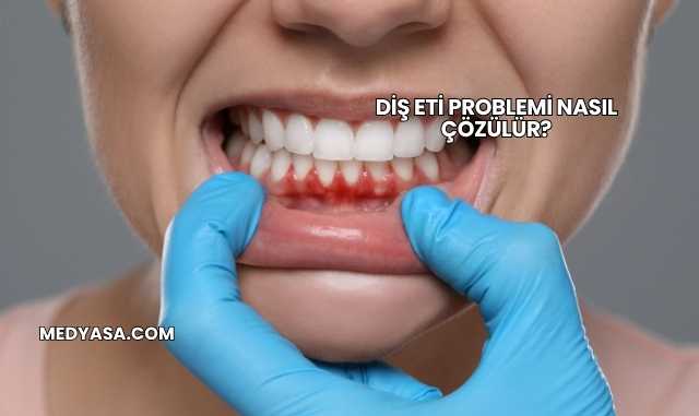 Diş Eti Problemi Nasıl Çözülür?