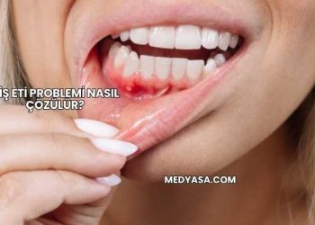 Diş Eti Problemi Nasıl Çözülür?