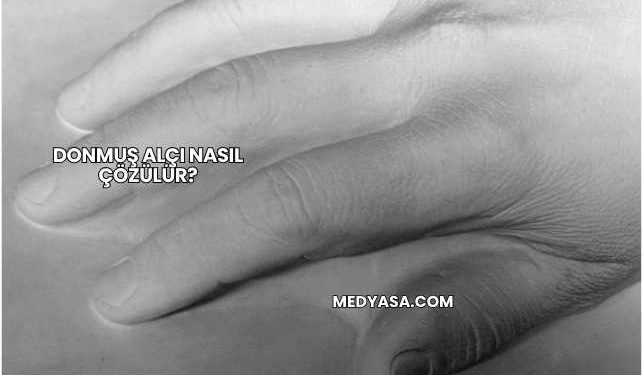 Donmuş Alçı Nasıl Çözülür?