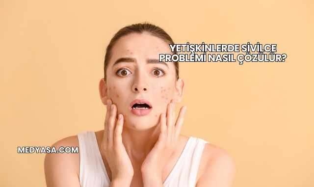 Yetişkinlerde Sivilce Problemi Nasıl Çözülür?