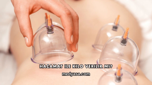 Hacamat ile Kilo Verilir mi?