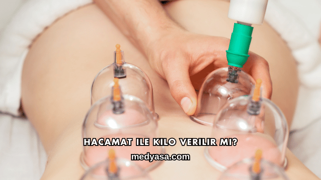 Hacamat ile Kilo Verilir mi?